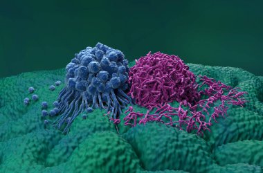 Mide kanseri hücreleri 3 boyutlu görüntüyü kapatır