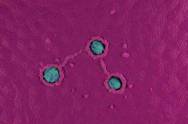 Cancer Surface Côlon Super Macro Cancer Colorectal Vue Dessus Illustration — Photo