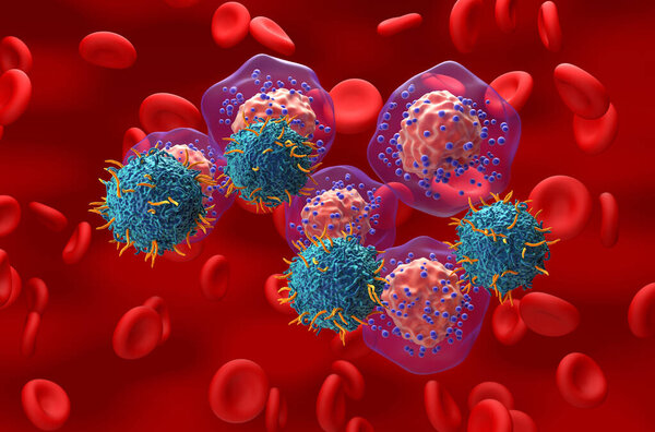 Терапия Т-лимфоцитов ЦАР при тройном отрицательном раке молочной железы - изометрический взгляд