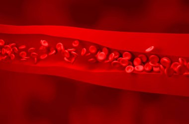 Yüksek tansiyon (Hipertansiyon) - Isometric view 3d illüstrasyon