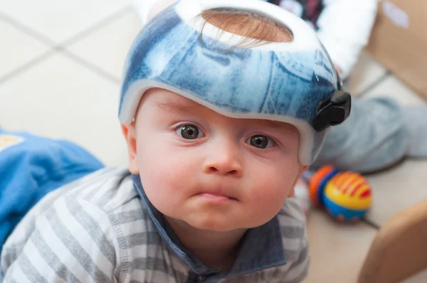 Criança em um capacete ortopédico Imagem De Stock