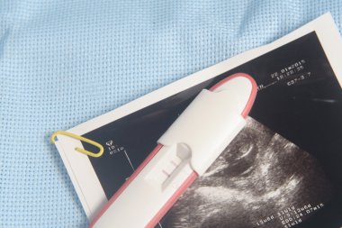 Hamilelik testi paketini mavi arka plan