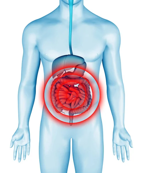 男性の体の3Dイラストに腸の痛み 解剖学的消化器系情報学の痛みを腸 腹が痛い 3Dレンダリング — ストック写真