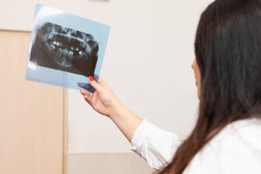 Kadın dişçi röntgen çekmek istiyor.