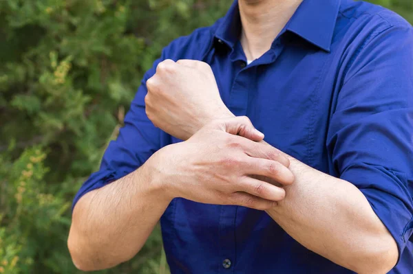 Adamın kolunun kaşınmasına yakın plan. Çünkü yeşil arka planlı bir parkta yakıyor.