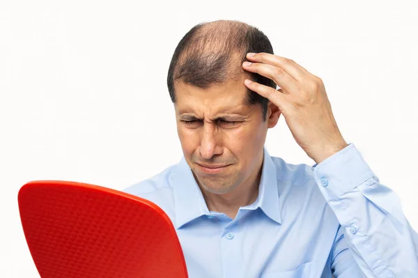 Upset Middle Aged Man Alopecia Looking Mirror Hair Loss Concept — Stock Photo, Image