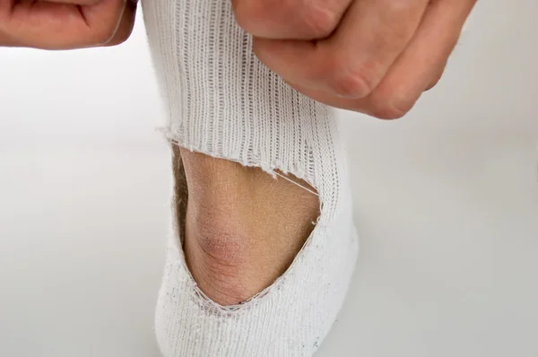 Broken sock — Stock Photo, Image