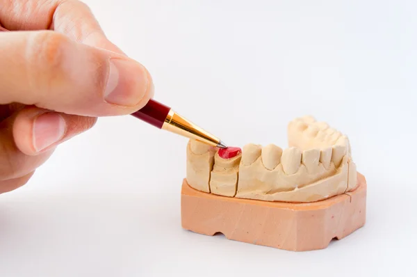 Modelli di gesso dentale — Foto Stock