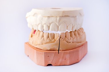 insan jaws prothetic