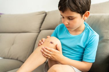 Eski yaralar ve taze kanla yere düştükten sonra yaralı dizlerini yaralayan küçük çocuğun yakın çekimi. Çocuk travmaları, kazalar ve tedavi, büyüme kavramı sorunları