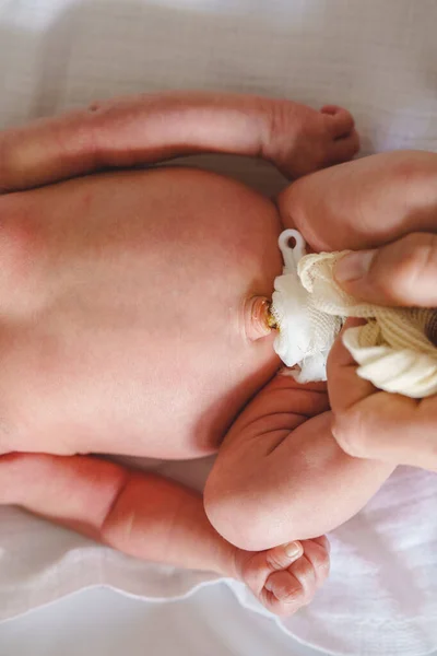 Manos Del Hombre Desconocido Padre Que Cuida Cordón Umbilical Con — Foto de Stock