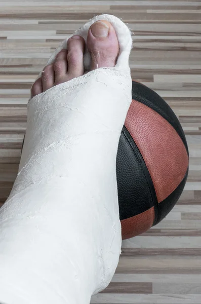 Perna quebrada e bola de basquete — Fotografia de Stock