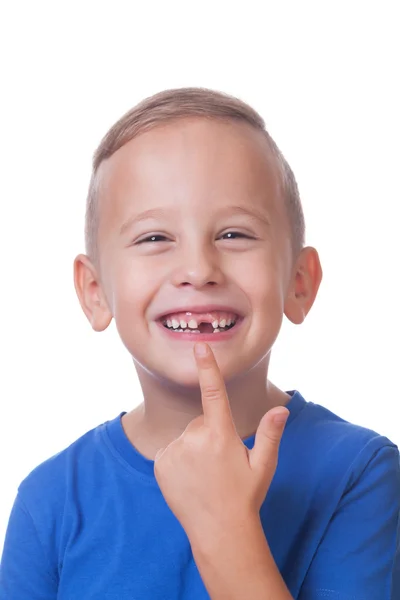 Minus one tooth — Stock Photo, Image