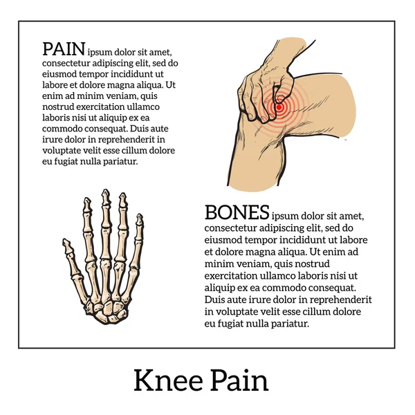 Barevné ilustrace bolest kolena. Ruce držící nohu — Stockový vektor
