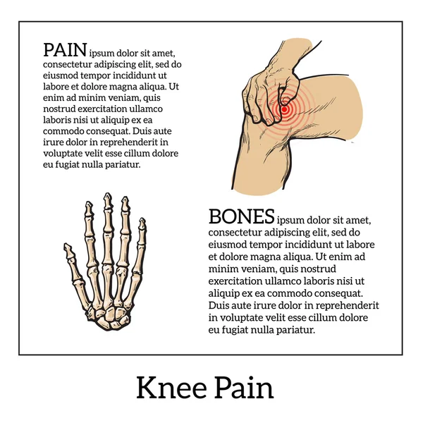 Ilustración a color del dolor de rodilla. Manos sosteniendo la pierna — Vector de stock