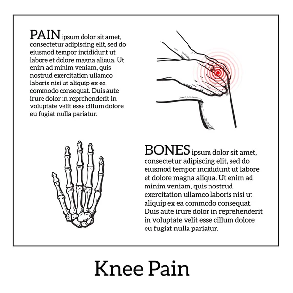 Illustratie van kniepijn. Handen met been — Stockvector