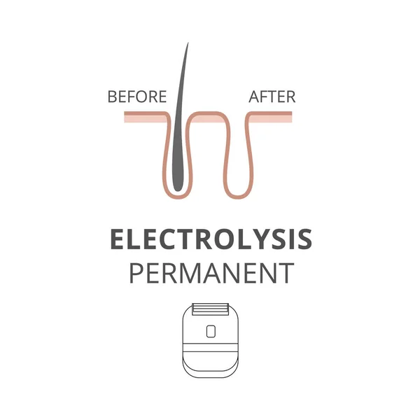 Electrolisis permanente para la depilación antes después de una ilustración vectorial. — Vector de stock