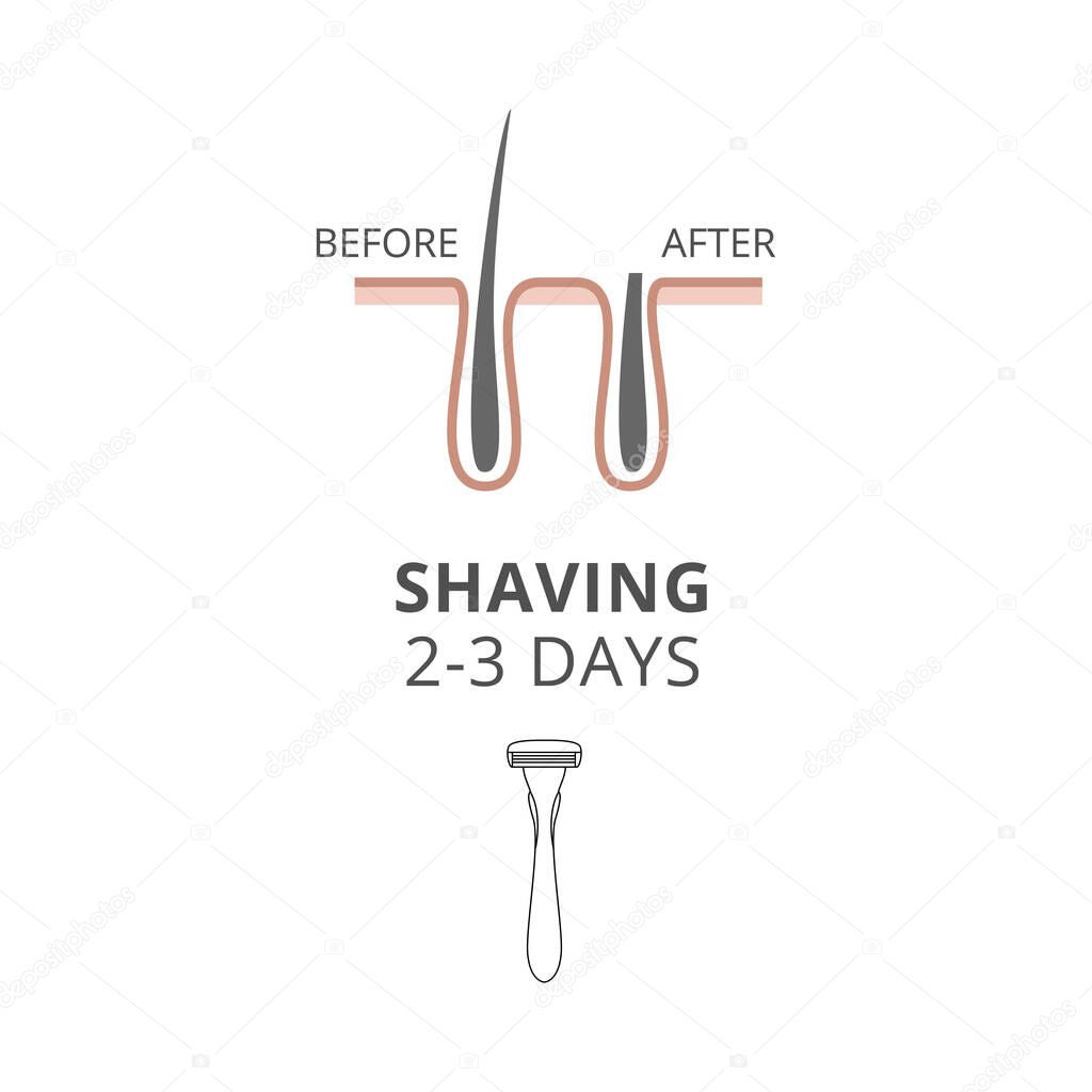 Hair removal using shave of razor before and after a vector illustration.