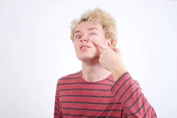 Young Blond Man Pointing Unhappy Pimple Forehead Ugly Infection Blackhead — Φωτογραφία Αρχείου