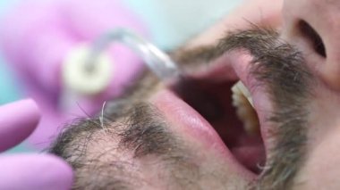 Diş hekimi randevusunda bıyıklı ve sakallı orta yaşlı bir adam.