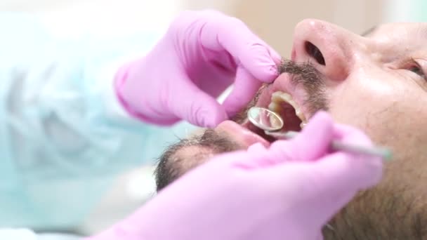 Homme d'âge moyen avec moustache et barbe au rendez-vous chez le dentiste — Video