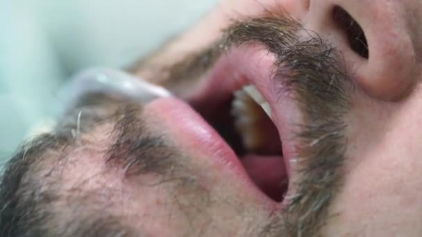 Homme d'âge moyen avec moustache et barbe au rendez-vous chez le dentiste — Video
