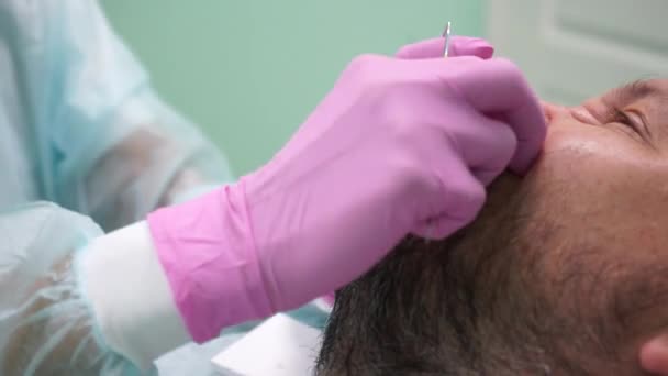 Homme d'âge moyen avec moustache et barbe au rendez-vous chez le dentiste — Video