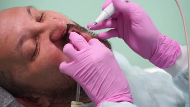 Homme d'âge moyen avec moustache et barbe au rendez-vous chez le dentiste — Video