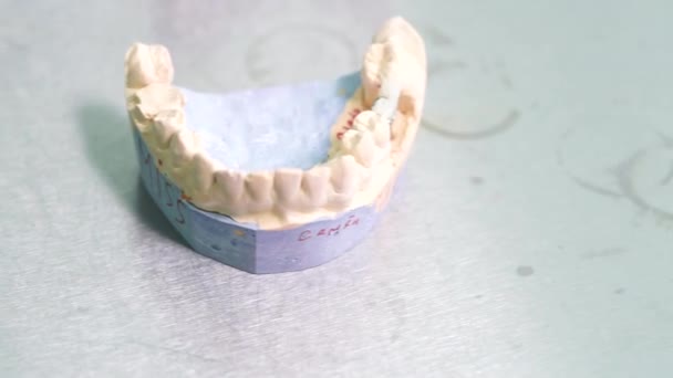 Mock up jaw on dentist table close up — Stock Video