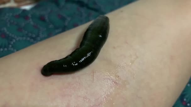 Sangsue médicale suce le sang sur la jambe de près — Video