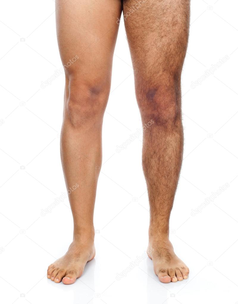 Male hair removal on legs Stock Photo by ©AntonioGravante 56049467