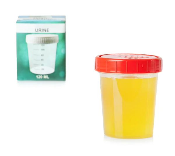 Urine sample in container — Stock Photo, Image