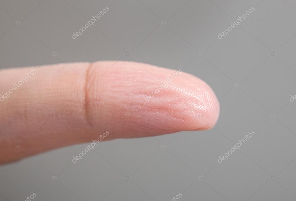 Puckered skin Stock Photos, Royalty Free Puckered skin Images |  Depositphotos