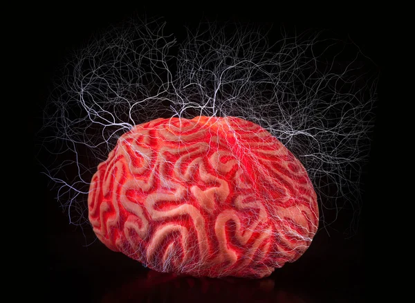 Menschliches Gummihirn mit Elektroschocks — Stockfoto