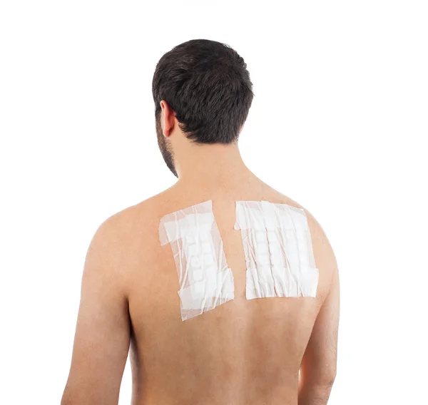 Skin Allergy Patch Test on Bacck — Stock Photo, Image