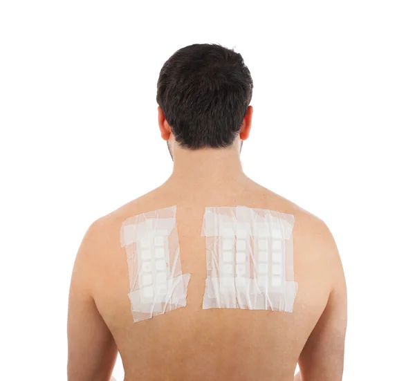 Skin Allergy Patch Test on Bacck — Stock Photo, Image