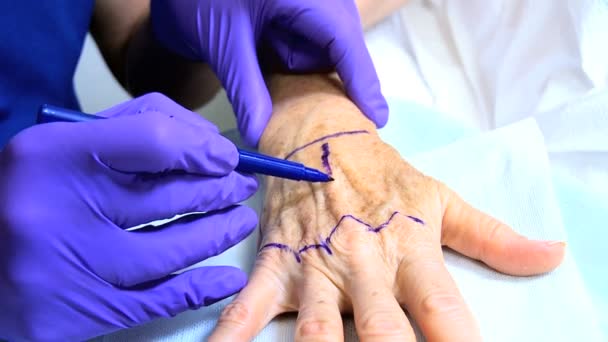 Pacient je připraven non chirurgické kosmetické ošetření — Stock video