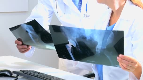 Doctores y doctores discutiendo pruebas de rayos X — Vídeos de Stock