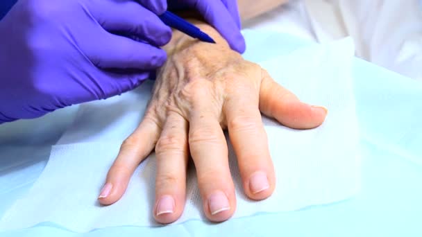 Пациент готовится к нехирургическому косметическому лечению — стоковое видео
