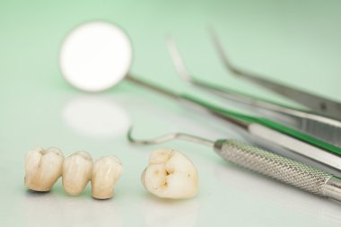 Metalsiz seramik diş kaplamaları