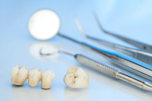 Ceramiczne korony dentystyczne bez metalu — Zdjęcie stockowe