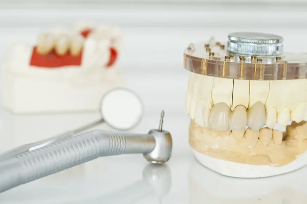 Ceramiczne korony dentystyczne bez metalu — Zdjęcie stockowe