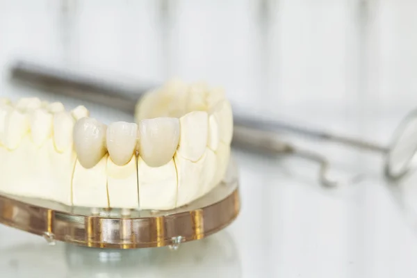 Corone dentali in ceramica senza metallo — Foto Stock