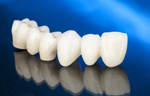 Ceramiczne korony dentystyczne bez metalu — Zdjęcie stockowe