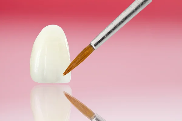 Metalsiz seramik diş kaplamaları