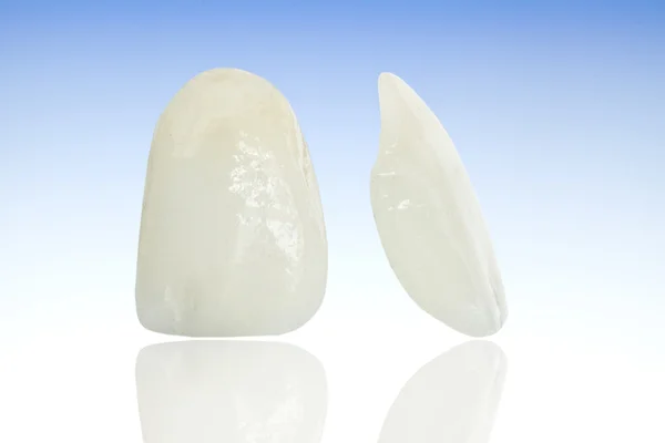 Ceramiczne korony dentystyczne bez metalu — Zdjęcie stockowe