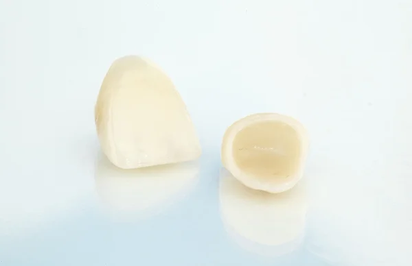 金属フリーセラミック歯科冠 ロイヤリティフリーのストック画像