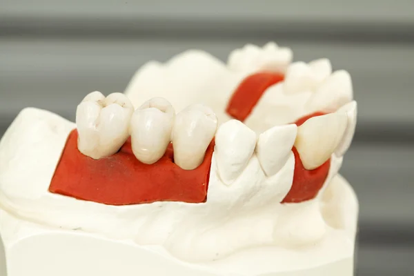 치과 건강 보험 — 스톡 사진