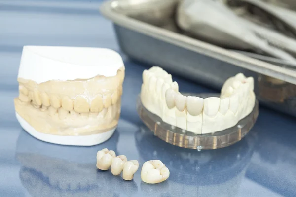 치과 건강 보험 가까이 보기 — 스톡 사진