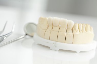 Alçı model üzerinde seramik Köprüsü